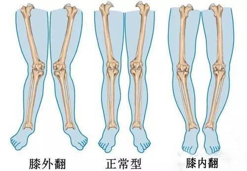 怎么让孩子腿又直又好看