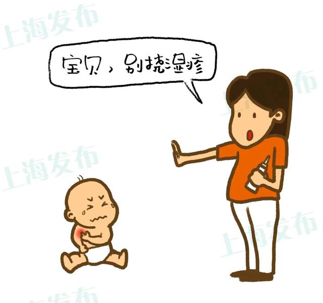 天气湿热怎么预防小儿湿疹