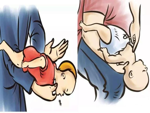 海姆立克法的操作步骤是什么样的