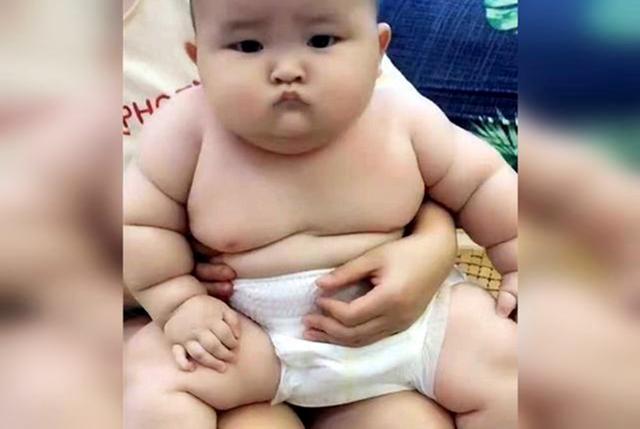 宝宝婴儿肥真的不用在意吗