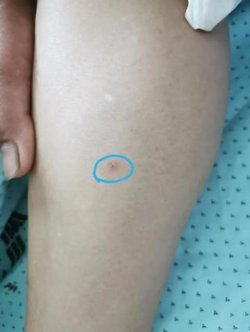 宁波市新冠这几天什么样