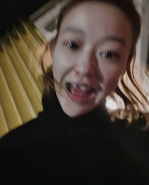 孩子摔跤磕到牙齿第一时间怎么处理