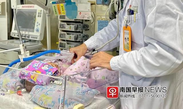 宝宝易患上蒙被综合征