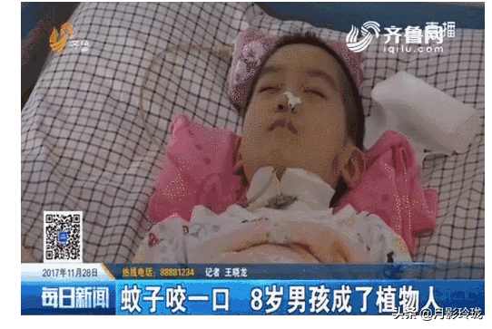 孩子被蚊子咬了之后会得乙脑吗