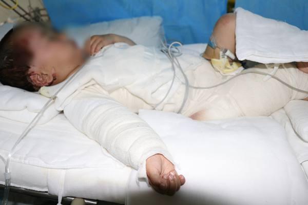 孩子生病怎样安慰妈妈 孩子生病怎样安慰妈妈