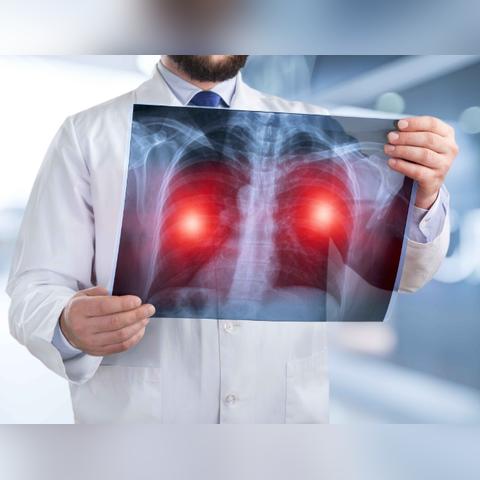 武汉市看肺癌找哪个医生