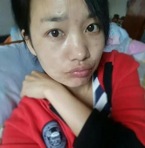为什么有些宝宝出生皮肤黄黄的