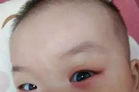 捏宝宝鼻梁会变挺吗