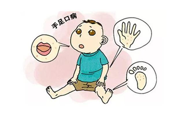 手足口病好了多久不会传染呢