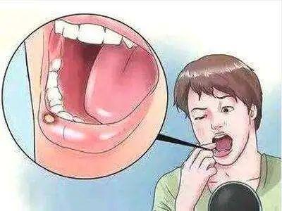 常见婴幼儿口腔疾病有哪些