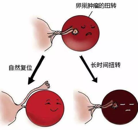 绝经后又出血做什么检查的长尾关键词有哪些