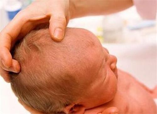 宝宝的囟门闭合越晚越聪明吗