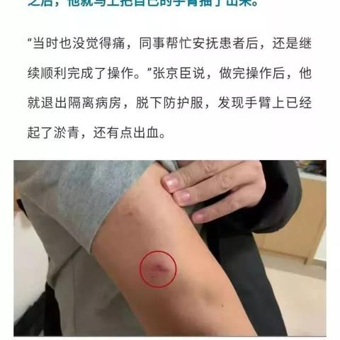 杭州肺炎首例的相关长尾关键词有哪些