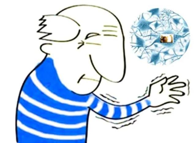 四肢抖动是得了帕金森病吗