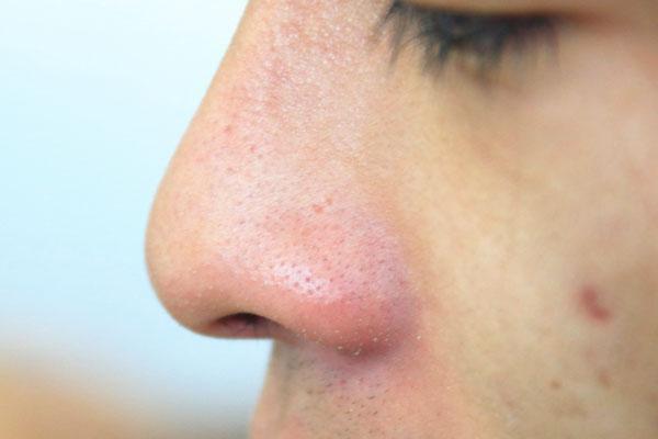 卵巢衰老的信号有哪些 卵巢衰老的信号有哪些