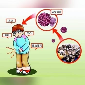 哈尔滨亚布力食物中毒相关长尾关键词有哪些