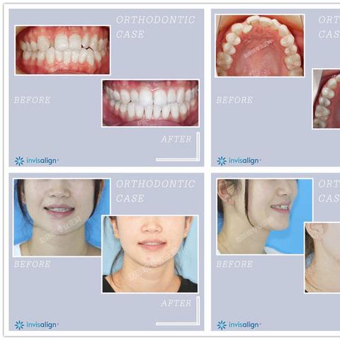 杭州市人民口腔科怎么样