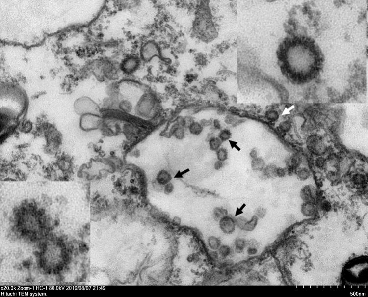 【河北邢台新冠病毒基因测序结果公布
 /河北邢台新冠病毒基因测序结果公布了吗】