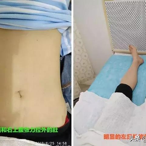 保定市耳鸣针灸专家的长尾关键词有什么