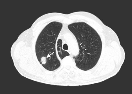 全国各城市感染进度排名
 ,全国各城市感染进度排名/全国城市新冠感染排名