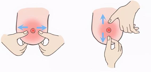 乳头内陷怎么挤出来图片
