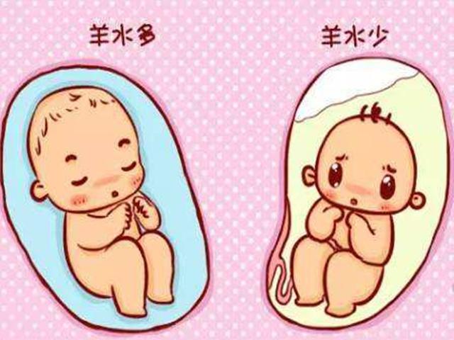羊水少不要怕，这些方法可增加羊水量