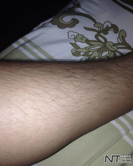 女人腿毛旺盛是什么原因 女人腿毛旺盛是什么原因