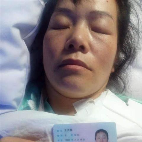 济南切除副乳相关长尾关键词有哪些