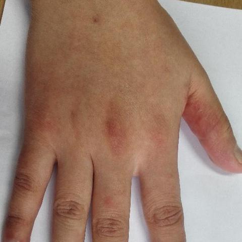 杭州市二医院有皮肤科吗？