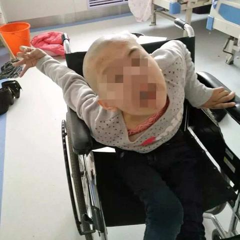 河南变形怎么样