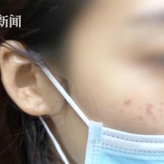 西安祛斑手术多少钱相关长尾关键词有哪些