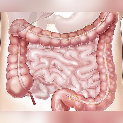 哈尔滨肛肠专科医院相关长尾关键词有哪些