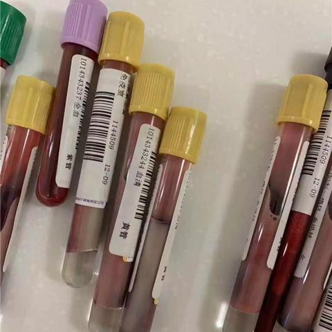 杭州市落户为什么要体检