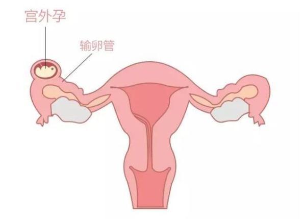 验孕棒一深一浅代表什么？是否就是怀孕了
