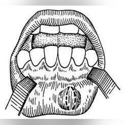 长沙市治疗卵巢囊肿的医院哪个强