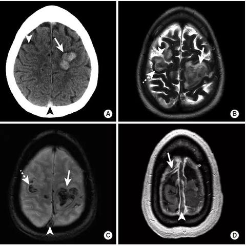 微商相册箭头怎么取消的长尾关键词有哪些