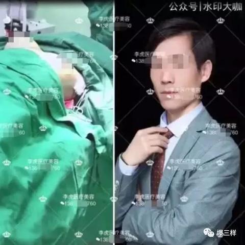 临沂市医院整形美容科怎么样