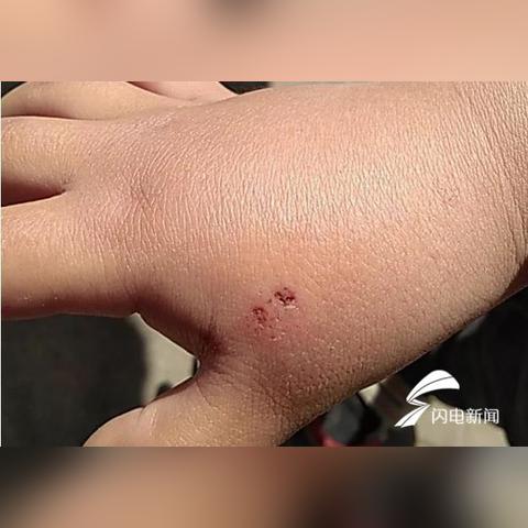 济南市去哪里打狂犬疫苗