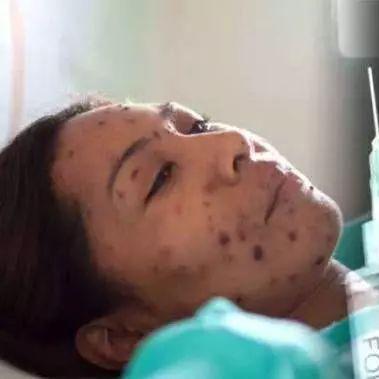 南宁市接种查验证明怎么开