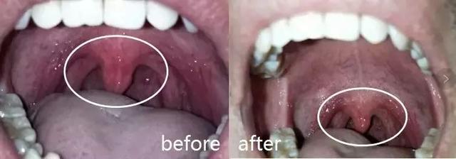 这些食疗方可缓解宝宝上火口臭