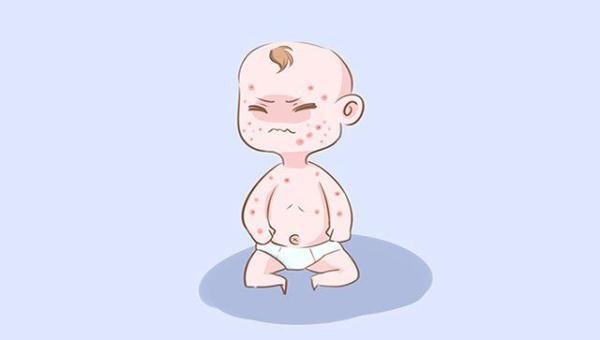 宝宝背上长了好多红疹是什么原因