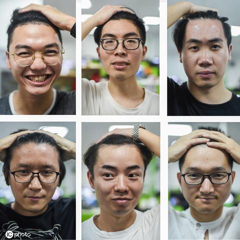 植发 杭州的相关长尾关键词有哪些