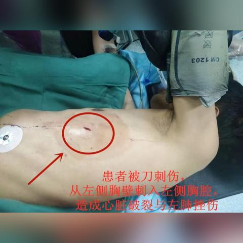 长沙市中心医院考什么