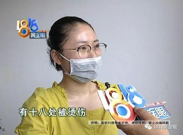 三伏贴灼伤孩童背部