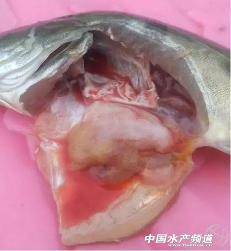 为什么新生儿感染细菌性败血症