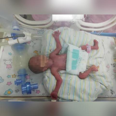 河南省人民医院剖腹产的相关长尾关键词有哪些