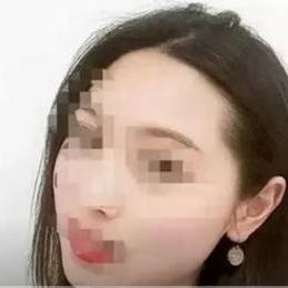 长春市哪里治牙便宜