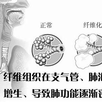 济南市充氧气在哪里买