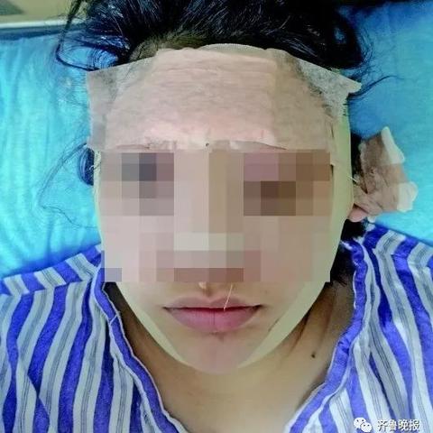 济南大腿吸脂价格相关长尾关键词有哪些