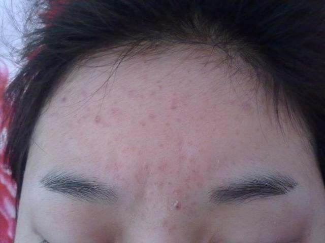 女人湿气重的症状有哪些 女人湿气重的症状有哪些